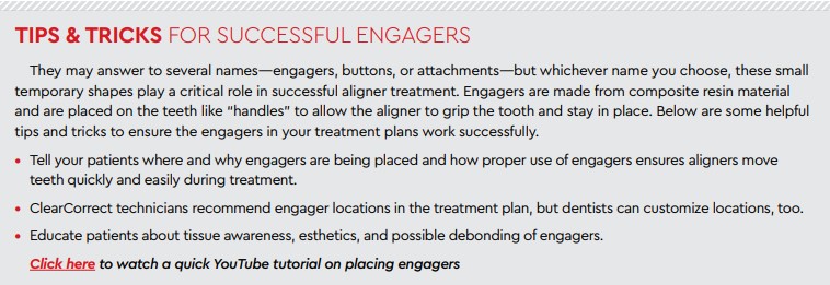 tips and tricks for successful engagers